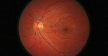 Early detection is vital